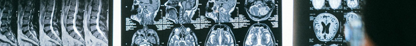 La industria de soluciones neurocientíficas utiliza tornillos, tuercas, pernos, arandelas y fijaciones de polímero